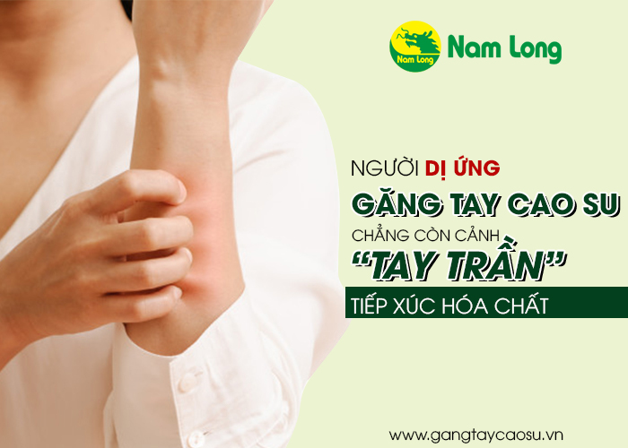 Người dị ứng găng tay cao su chẳng còn cảnh “tay trần” tiếp xúc hóa chất - 01