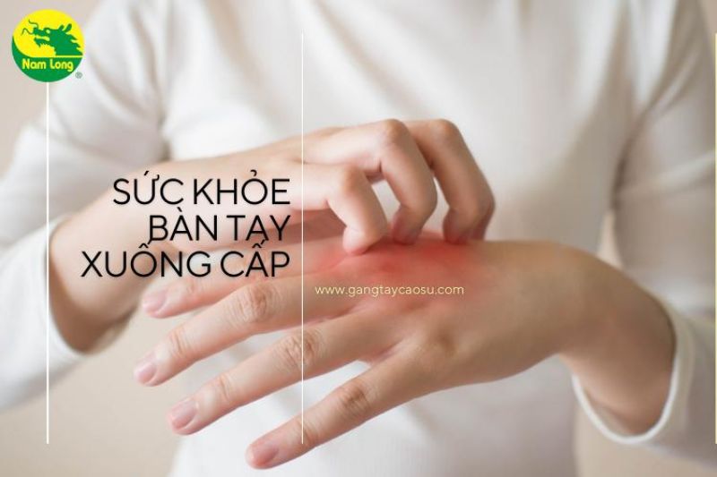 găng tay cao su Nam Long - 2 “giá phải trả” khi không dùng găng tay cao su dọn dẹp vệ sinh