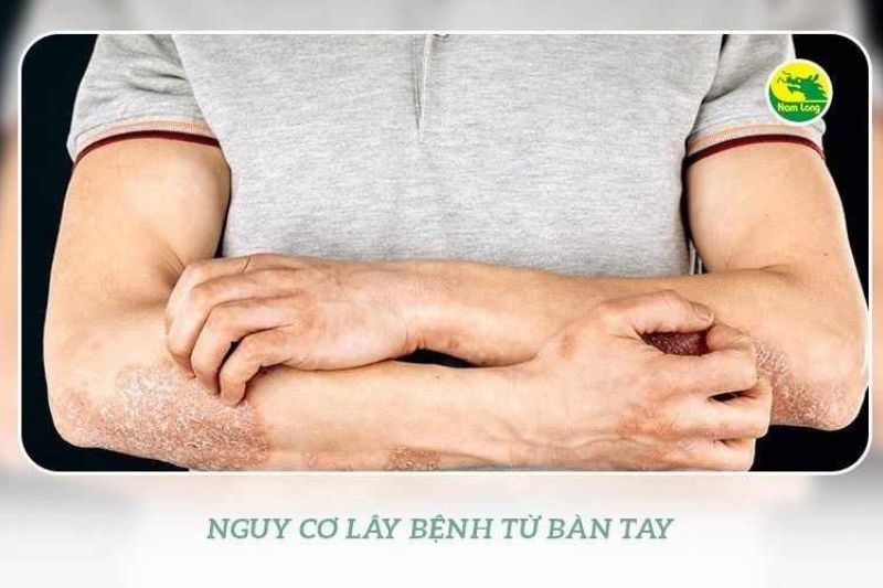găng tay cao su Nam Long - 2 “giá phải trả” khi không dùng găng tay cao su dọn dẹp vệ sinh